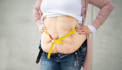 Ein neues Lebensgefühl. Eine Frau hat viel Gewicht nach einer Magenverkleinerung verloren. Auf dem...