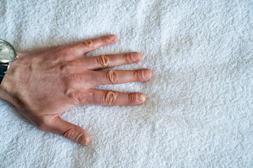 man's hand on a white bed sheet. skin care products. cosmetics, cream and medicines for itching, allergies.