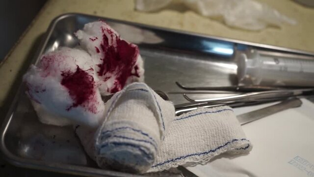 Ustensiles de m&eacute;decine. Compresses avec du sang, bandages, pinces et seringue sur un plateau de fer.