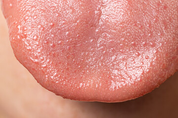 Macro close up surface of human tongue - sensory receptors of the papillae, tip of the tongue. © Zarina Lukash