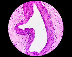 Microscopic image of histological slide, histopathology