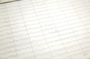 a card with a cardiogram of the heart. High quality photo