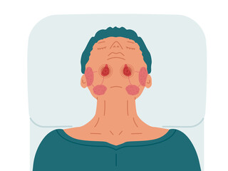A patient with diseased sublingual salivary glands. Vector illustration of sialolithiasis.