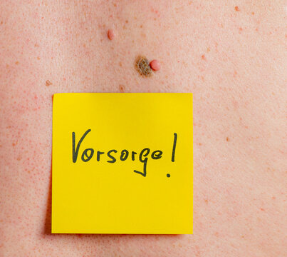 Muttermal oder Leberfleck auf der Haut, Vorsorge Krebs