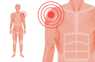 Shoulder pain concept