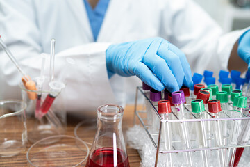 Scientist holding and analysis tube of micro biological sample outbreak Coronavirus or Covid-19 infectious in laboratory for doctor in the world.