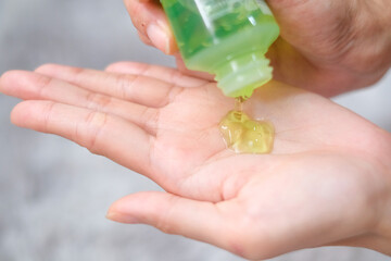 Woman applying aloe vera gel on hand with carpet background, Health care concept.