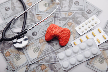 Treatment of diseases of thyroid concept. Model of organ, pills and money