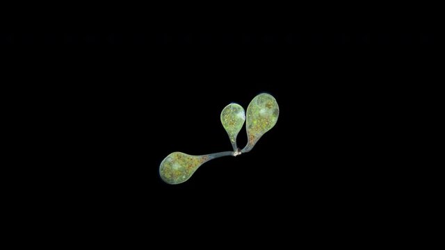 infusoria Stentor sp. under the microscope, family Heterotrichida. They live in seas and fresh waters. They feed on bacteria, algae, protozoa
