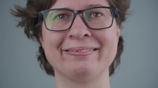 Smiling Young Caucasian Woman With Broken Front Tooth From Which Fiberglass Pins Sticking Out. Tooth Injury, Chipped Tooth Half After Accident. Dentistry And Maxillofacial Treatment. Dental Trauma