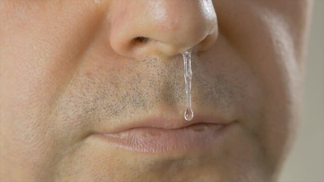 Close-up of an adult man's face with drooping snot from his nose