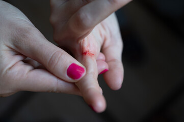 Close-up of a finger of a human hand cut painfully, bleeding bright red blood.