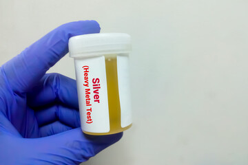 Urine sample for Silver (heavy metal) test, toxic metal. Diagnosis of silver toxicity