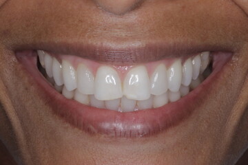 Obraz premium dentist