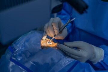 Eye surgery.A patient and surgeon in the operating room during ophthalmic surgery.Patient under...