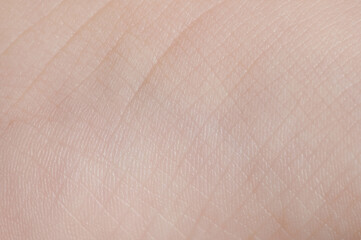 Lines on baby foot skin