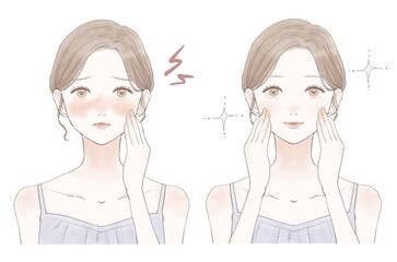 スキンケア　女性　赤み　ビフォーアフター