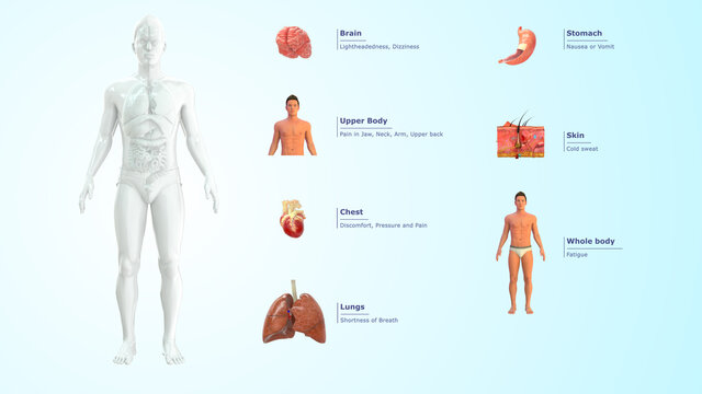 Heart Attack Symptoms
