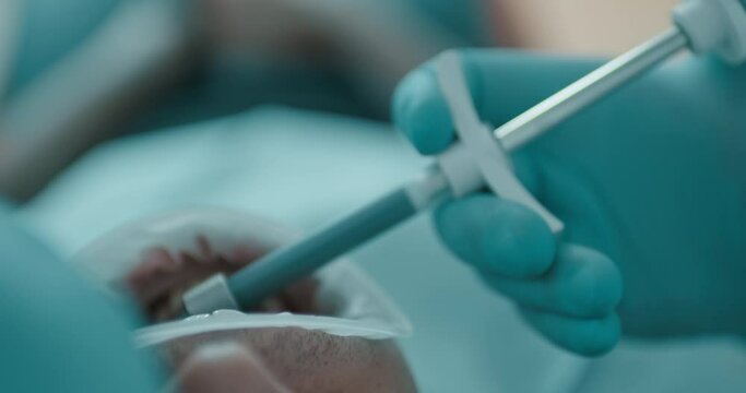 Close-up a male patient who laying wearing a mouth opener while the dentist hand filling on the teeth an impression paste inside of the elastomeric syringe.