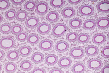 Characteristics of fungi living in wood as a group, are polyphyletic under the microscope for education.
