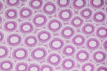 Characteristics of fungi living in wood as a group, are polyphyletic under the microscope for education.
