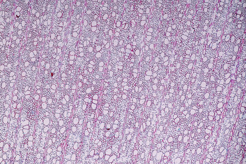 Characteristics of fungi living in wood as a group, are polyphyletic under the microscope for education.
