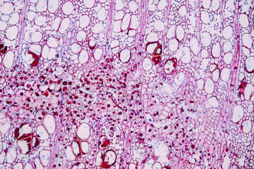 Characteristics of fungi living in wood as a group, are polyphyletic under the microscope for...