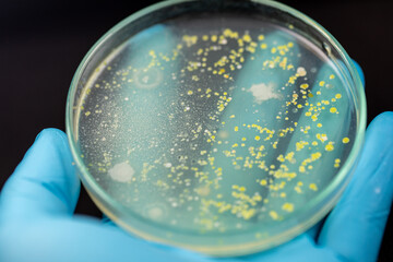 Backgrounds of Characteristics and Different shaped Colony of Bacteria and Mold growing on agar plates from Soil samples for education in Microbiology laboratory.
