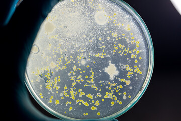 Backgrounds of Characteristics and Different shaped Colony of Bacteria and Mold growing on agar plates from Soil samples for education in Microbiology laboratory.
