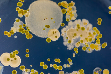 Backgrounds of Characteristics and Different shaped Colony of Bacteria and Mold growing on agar...