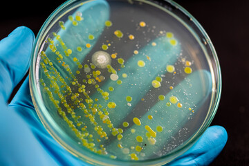 Backgrounds of Characteristics and Different shaped Colony of Bacteria and Mold growing on agar plates from Soil samples for education in Microbiology laboratory.
