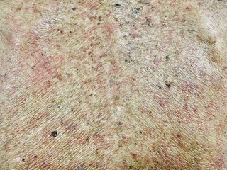 The texture of old man's skin. Can see the details of the skin color and the cracks on the skin.