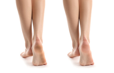 Legs of young woman before and after pedicure on white background