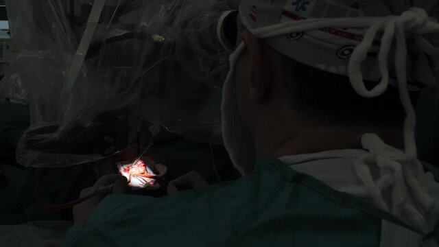 neurosurgery surgery, neurosurgeon removes the tumor from the head
