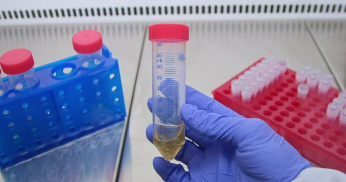 Scientist holds in his hand a large test tube with a culture of bacteria in the form of small lumps in a yellow liquid, shakes the contents of the test tube.