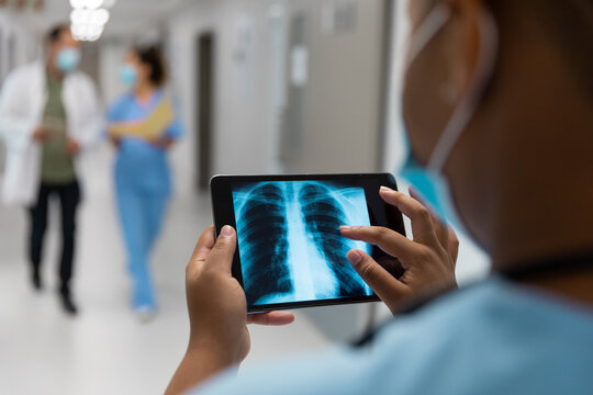 Mixed race doctor in corridor wearing face mask looking at lung x-ray on tablet
