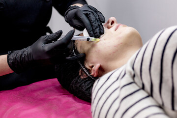 Cosmetologist doctor is making multiple injections biorevitalization with hyaluronic acid in woman...