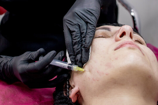 Face mesotherapy procedure in a beauty salon. Beautician doctor makes injections into the skin of the face of woman.Mesotherapy, biorevitalization.Close-up. Selective focus.