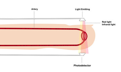 Principle of reading pulse oximeter. Components of a pulse oximeter sensor. Emission of light through blood capillaries oximetry - obrazy, fototapety, plakaty