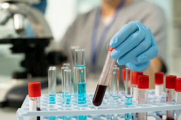 Examining blood sample in laboratory