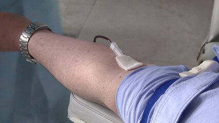 Close up of a patient transfused in hospital ward. Close the doctor's hands while gluing the needle into the male hand for taking blood samples. Blood donor for donation, transfusion. 
 - Powered by Adobe