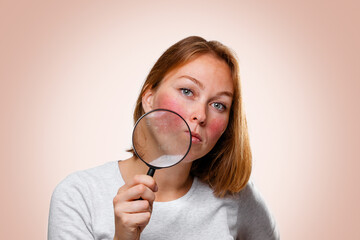 Portrait of a woman showing redness on her cheeks, through a magnifying glass. Pink background. The concept of rosacea
