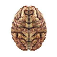 Unhealthy Human Brain Anatomy Isolated