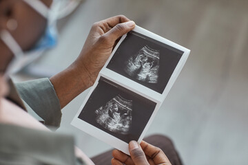 Close-up of woman looking at ultrasound image in her hands during her visit at hospital