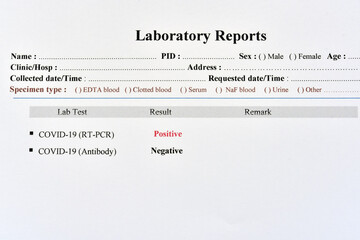 COVID-19 test results by using RT-PCR method and rapid test antibody method, the results showed positive and negative respectively