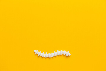 Human spine organ model on yellow background. Treatment of a herniated disc. Copy space for text.