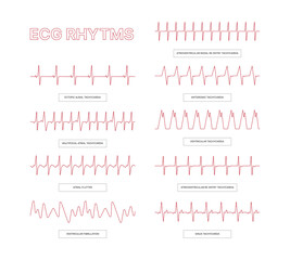 Ecg templates. Medical infographic lines heart arrhythmia health conceptual pictures for doctors info garish vector ecg illustrations