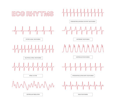 Ecg templates. Medical infographic lines heart arrhythmia health conceptual pictures for doctors info garish vector ecg illustrations