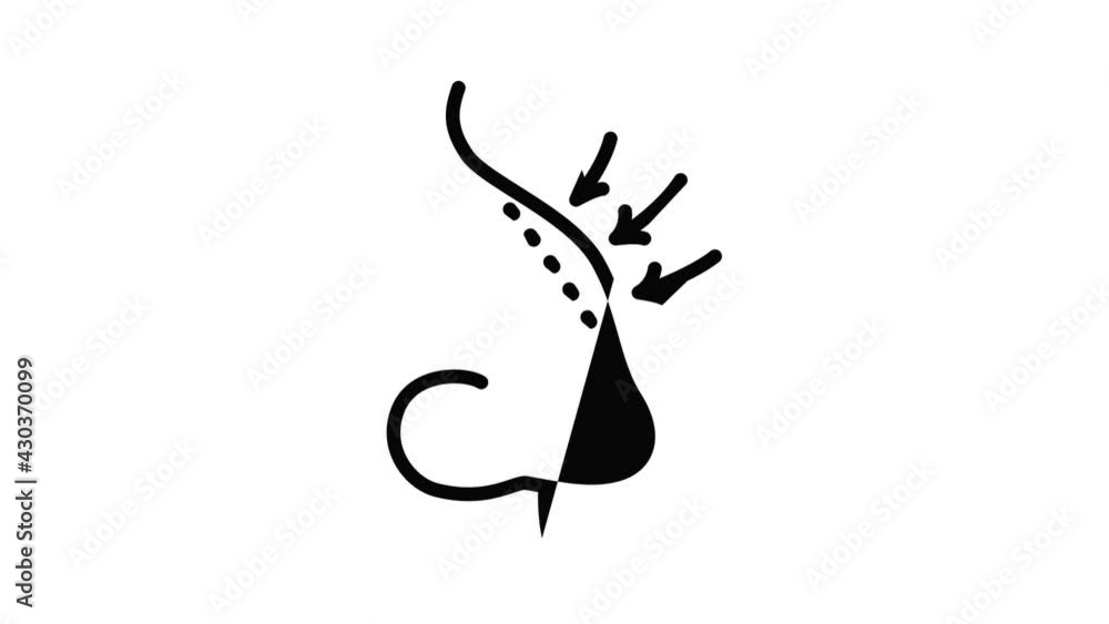 Poster nose correction icon animation outline best object on white background