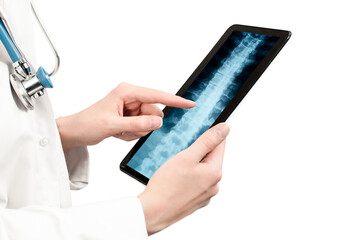 doctor looking at spine x-ray on digital tablet screen on white isolated background